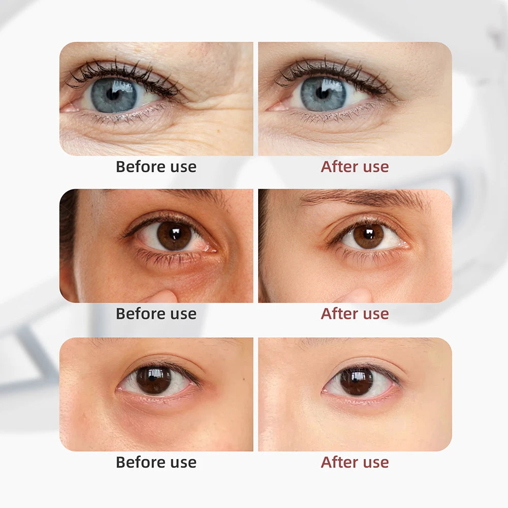 Celeste Eye Sculptor